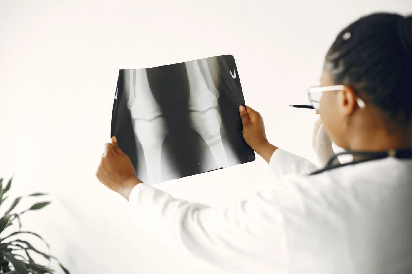 Especialista evaluando radiografías de rodilla